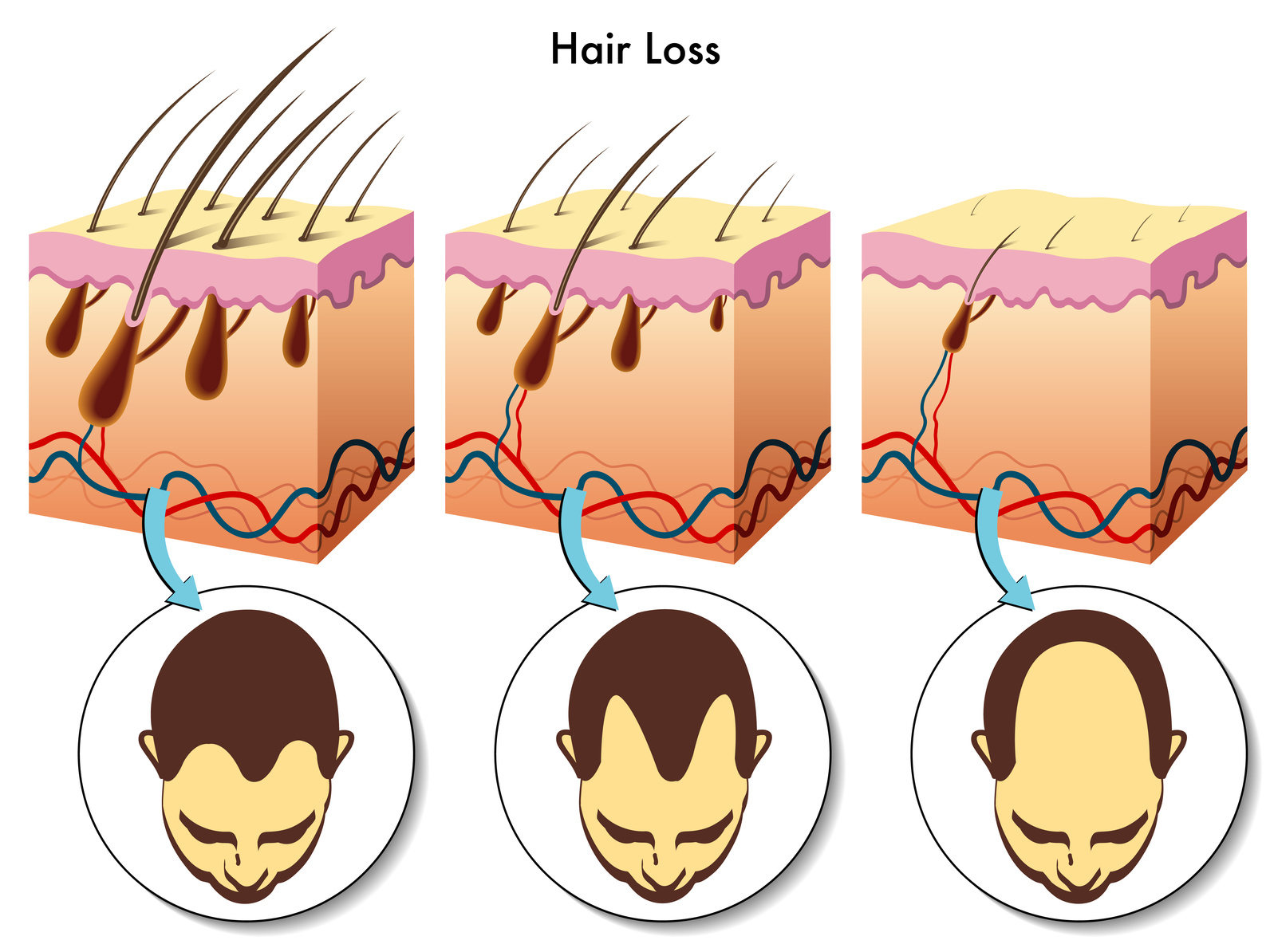Fakta o vypadávání vlasů. Co můžeme změnit?