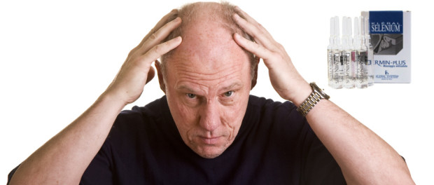 An older man leaning over with his hands on his bald head padání vlasů léky