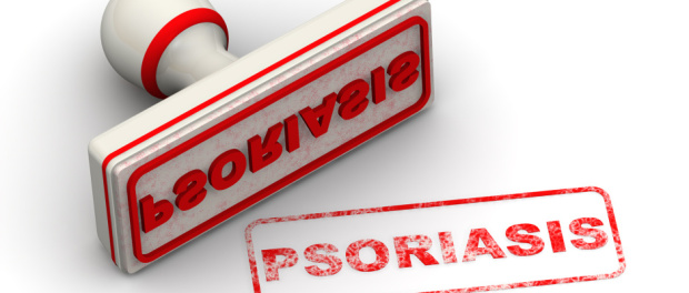Psoriáza lupénka Psoriáza lupénka