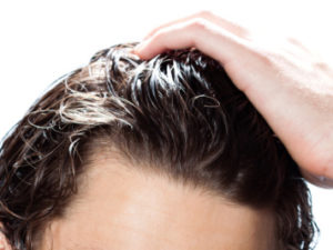 náhrada vlasů a integrace vlasů